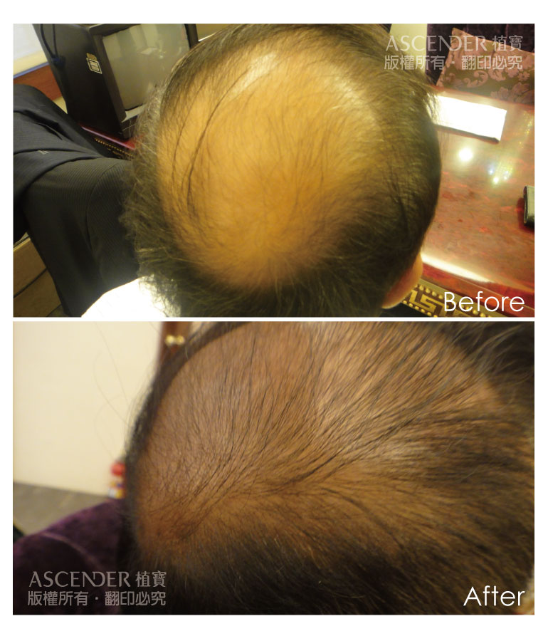 hair03 p01